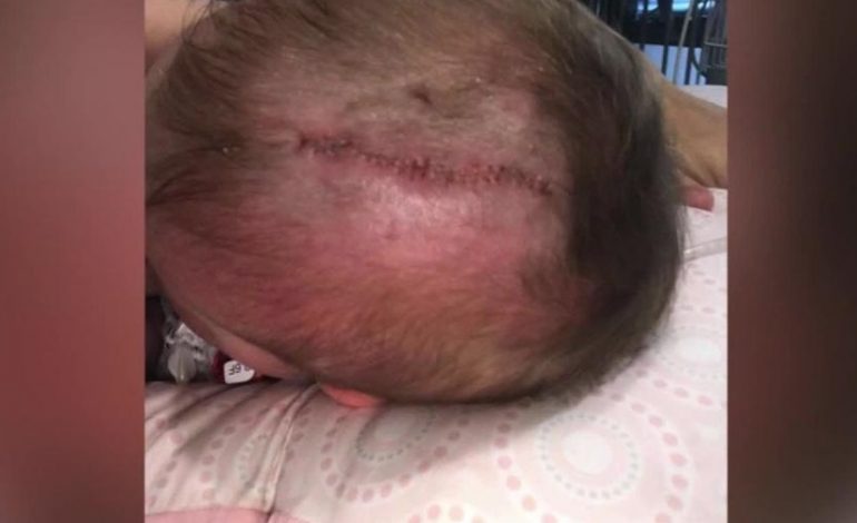 Un bébé de 6 mois attaqué sauvagement par un chien