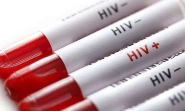 Un pas prometteur pour détruire les cellules infectées par le VIH