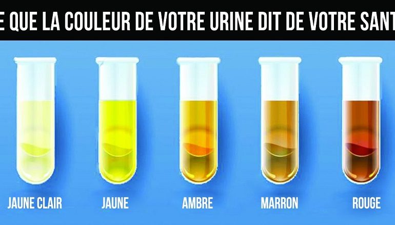 Ce que la couleur de votre urine révèle sur votre état de santé