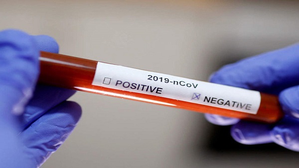 Coronavirus : le test du professeur du Campus Roi Henry Christophe s’est révélé négatif
