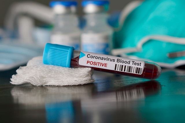 Coronavirus : Plus d’un million de malades et 53 mille décès dans le monde